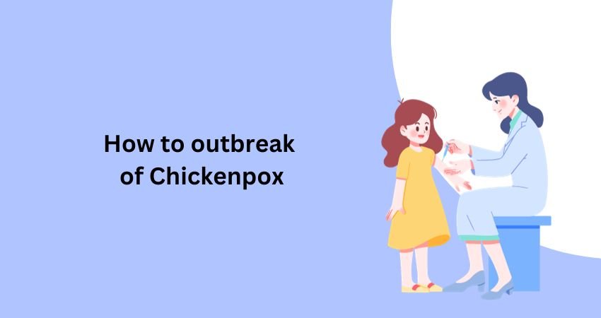 How to spread chickenpox?